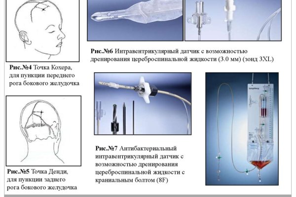 Ссылка на кракен тг